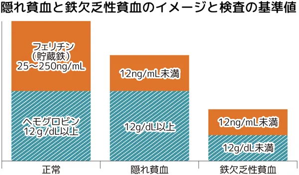 隠れ貧血と鉄欠乏性貧血のイメージと検査の基準値。正常 フェリチン(貯蔵鉄)25~250ng/mL、ヘモグロビン12g/dL以上。隠れ貧血 フェリチン(貯蔵鉄)12ng/mL未満、ヘモグロビン12g/dL以上。鉄欠乏性貧血 フェリチン(貯蔵鉄)12ng/mL未満、ヘモグロビン12g/dL未満